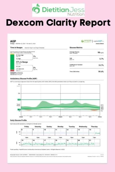 dexcom clarity report